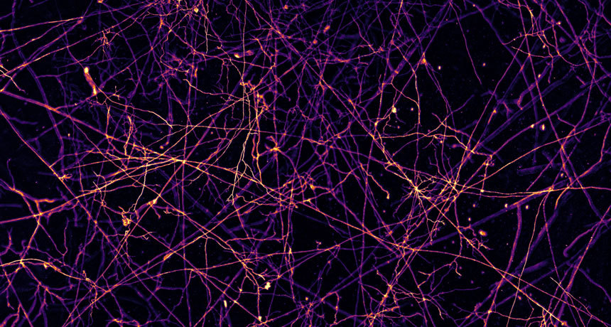 真菌在土壤中綿密的網絡(photo by www.sciencenews.org)